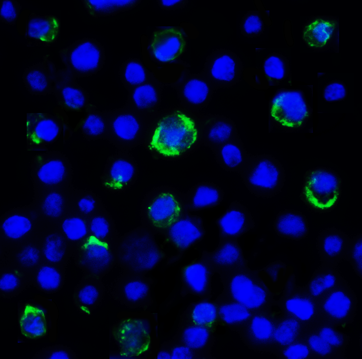 LAG3 Antibody [5F11]
