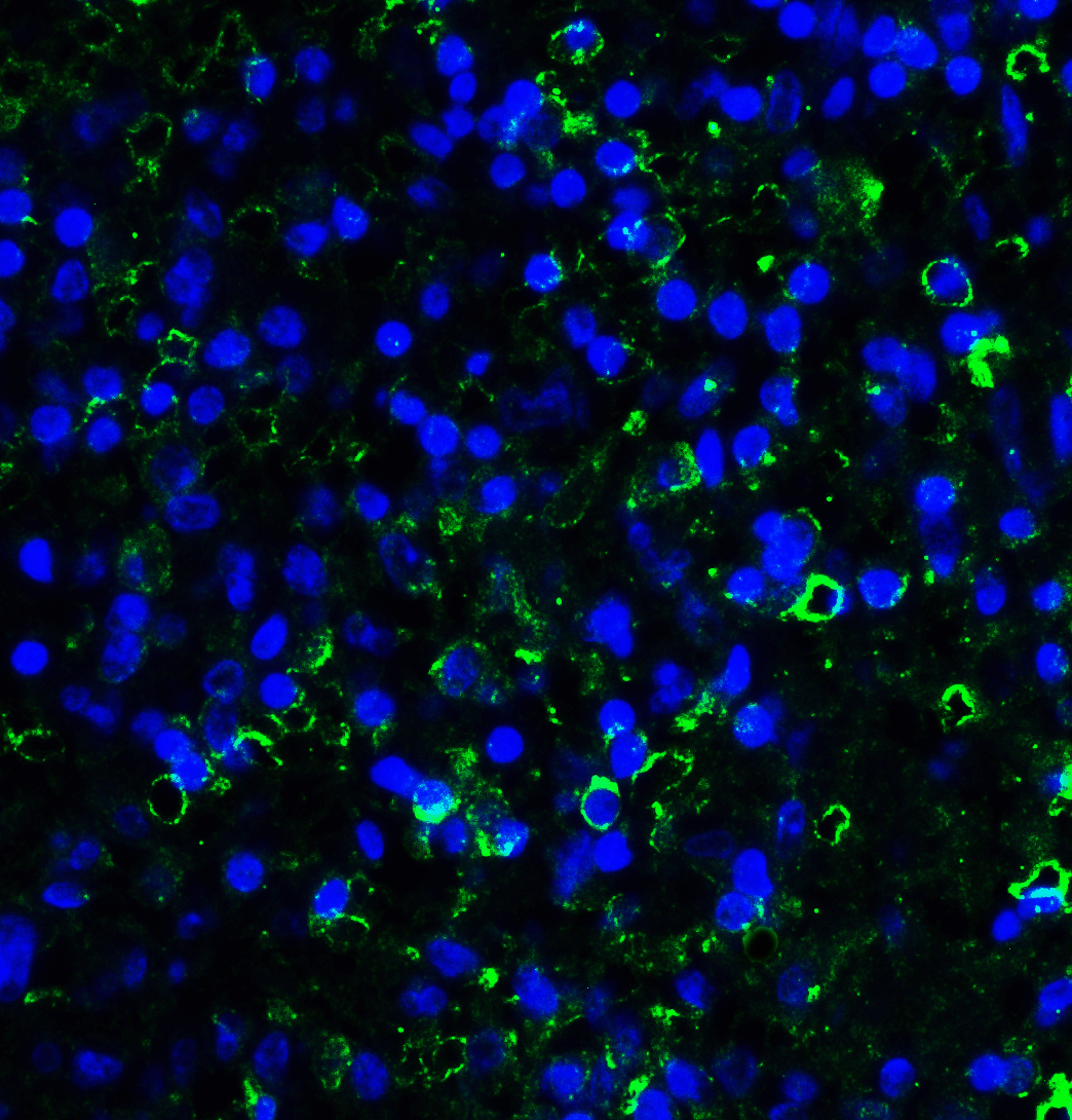 LAG3 Antibody [5F11]