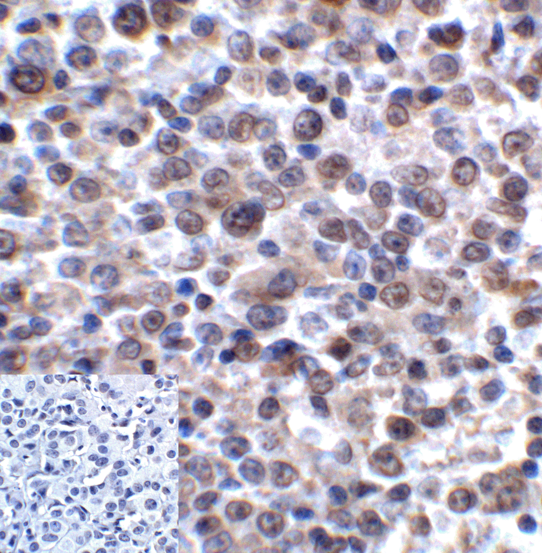 LAG3 Antibody