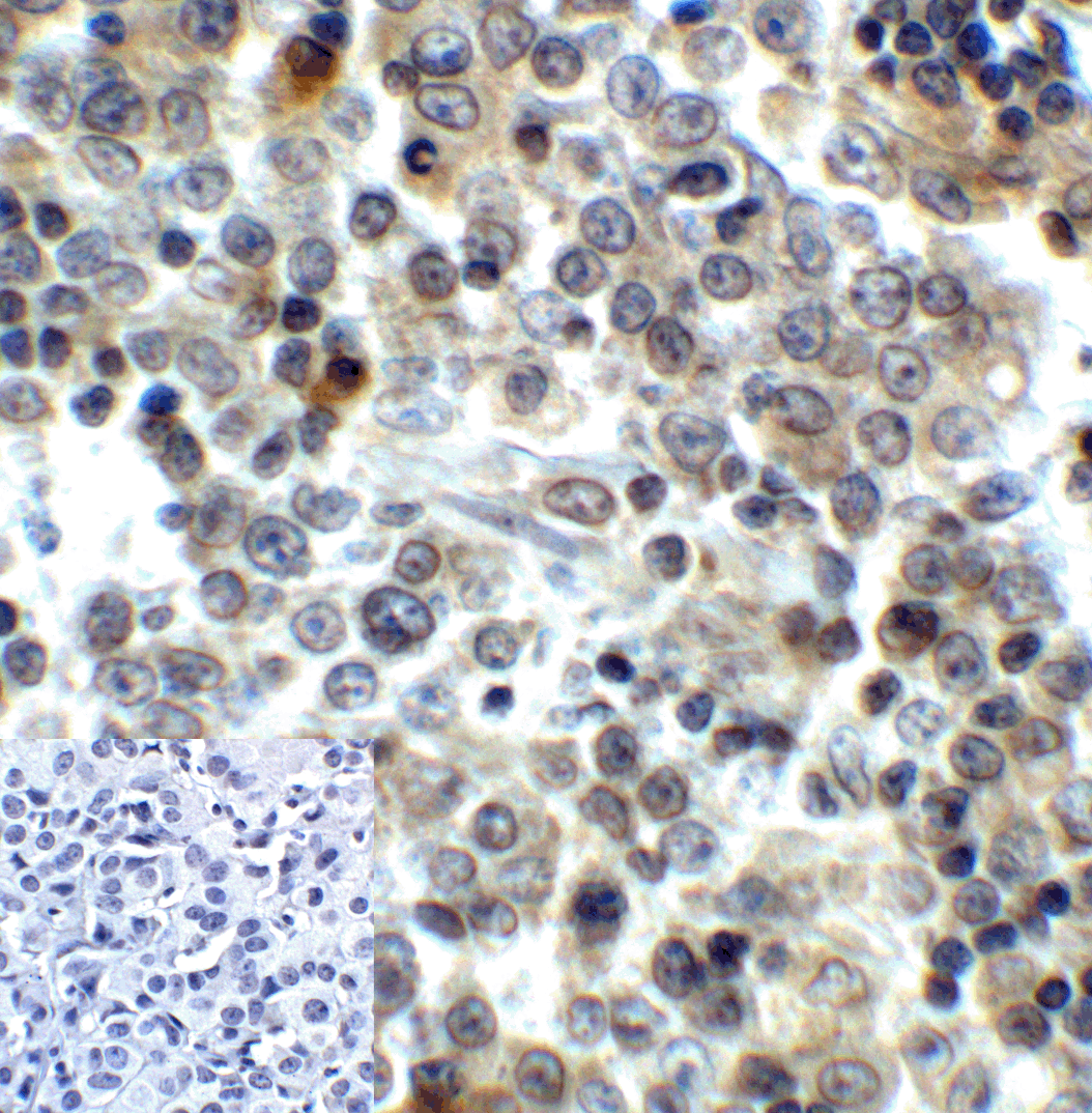 LAG3 Antibody [6B12]