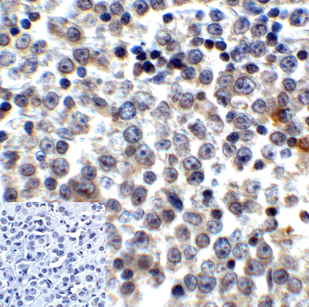 LAG3 Antibody [6D1]