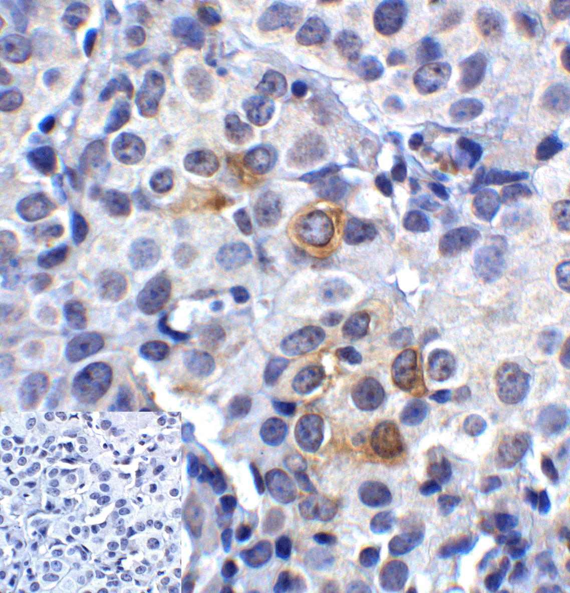 LAG3 Antibody