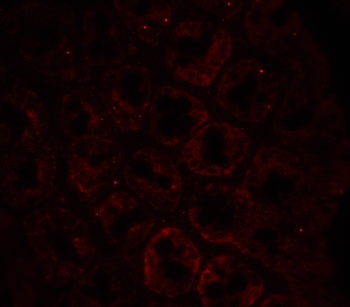 LAMP1 Antibody