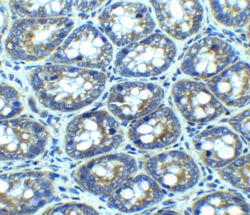 LAMP-1 Antibody