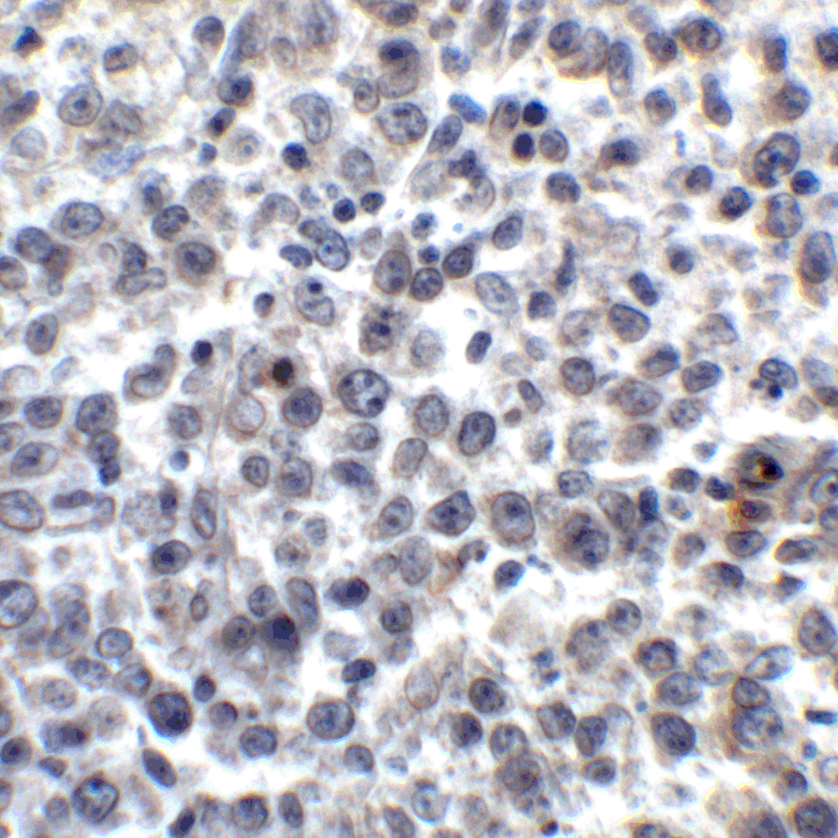 LIGHT Antibody [7B9E12]