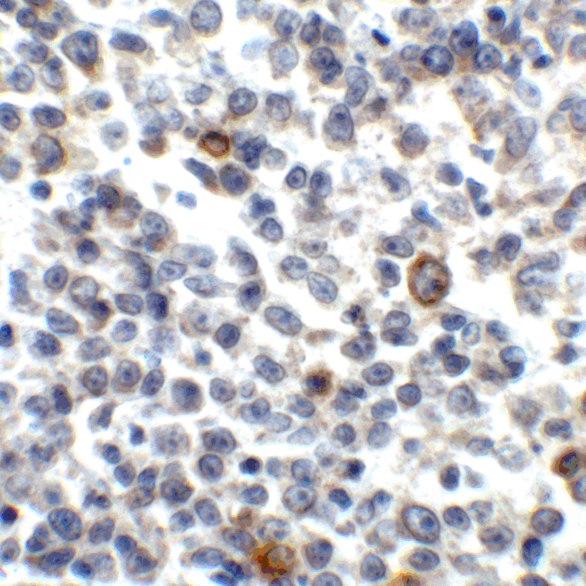 TNFSF14 Antibody