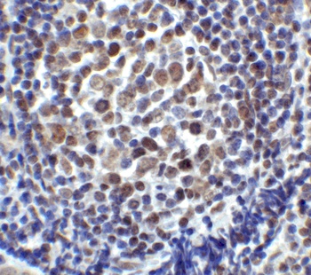 LAG3 Antibody