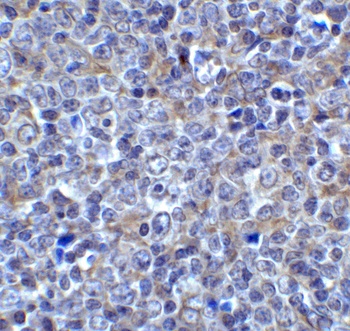 LAG3 Antibody