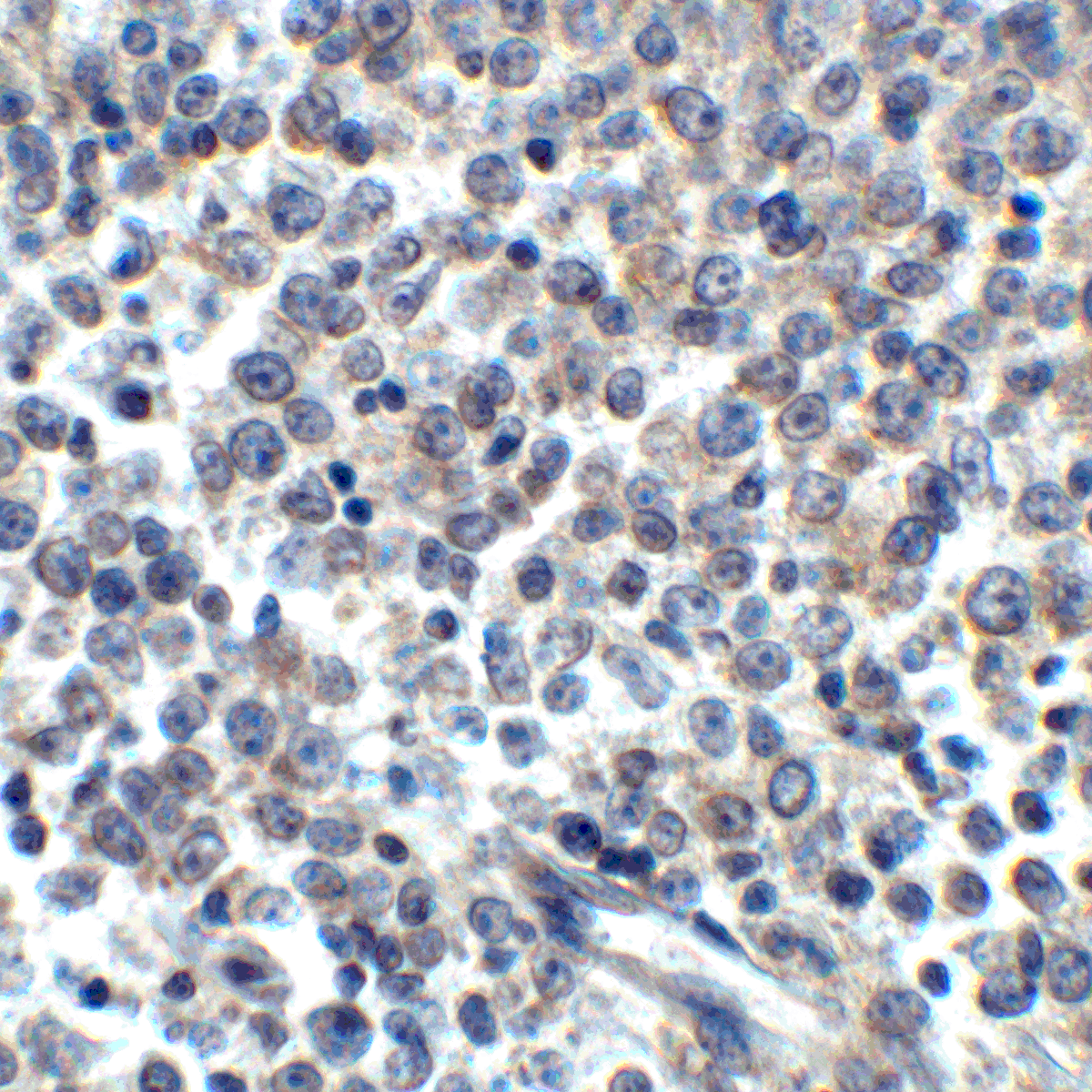 LIGHT Antibody [7B9H9]