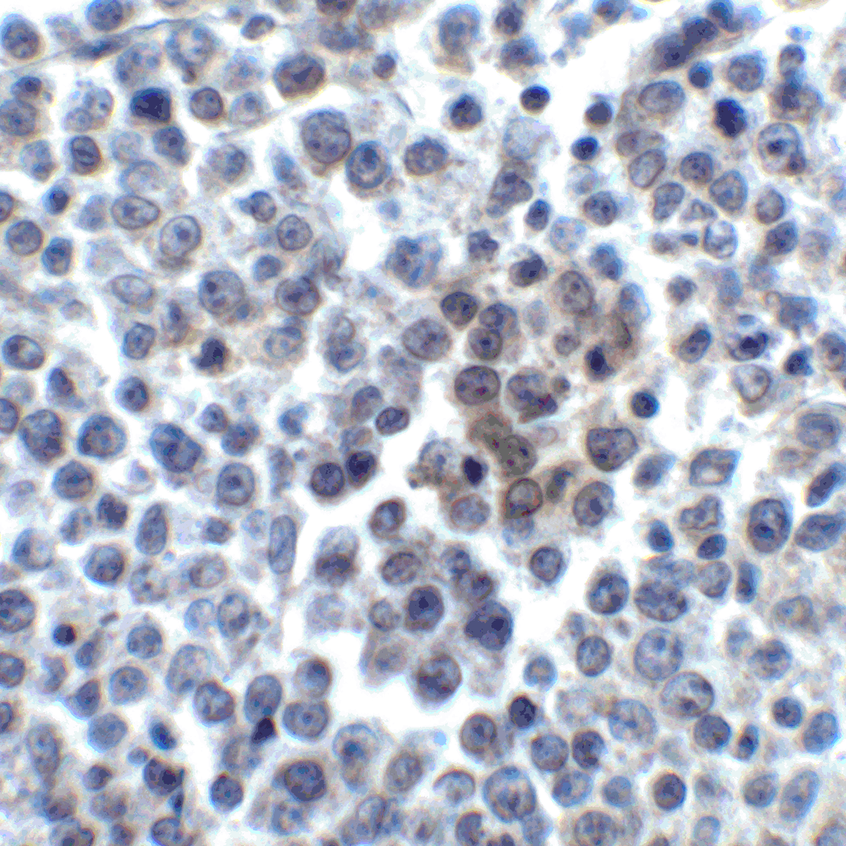 TNFSF14 Antibody