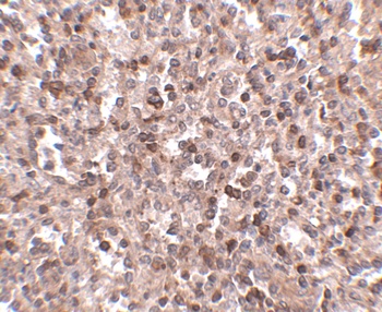 KLRA1P Antibody