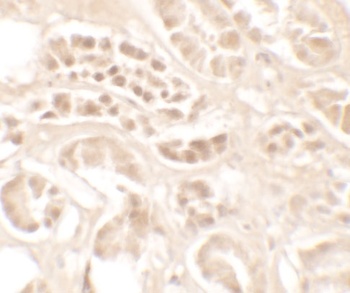 KLK4 Antibody