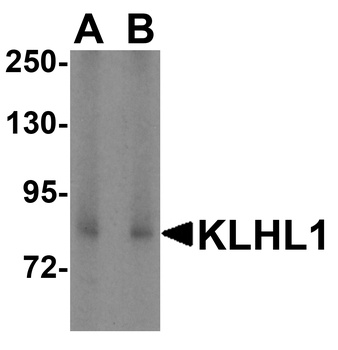 KLHL1 Antibody