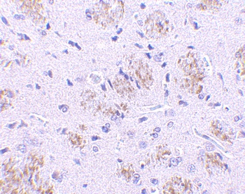 KLHL1 Antibody