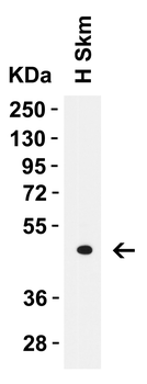 LMX1A Antibody