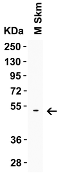 LMX1A Antibody