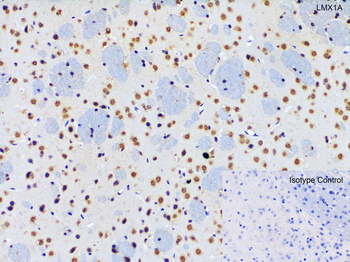 LMX1A Antibody