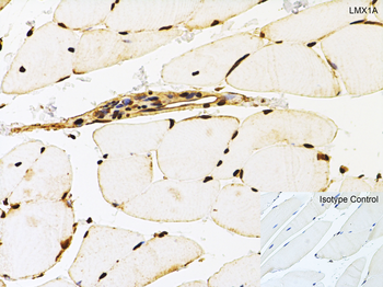 LMX1A Antibody