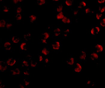 KIF5 Antibody