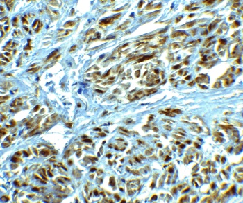LRRC26 Antibody
