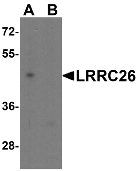 LRRC26 Antibody