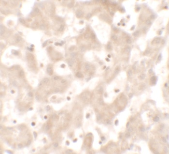 KHDC1 Antibody