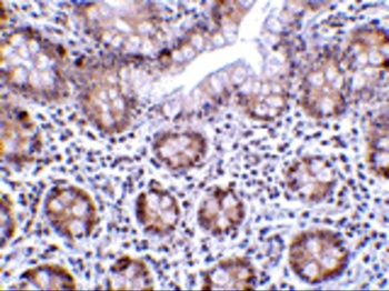 LSD1 Antibody