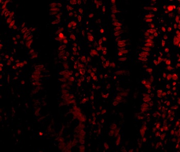 LSD1 Antibody
