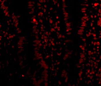 KDM1A Antibody