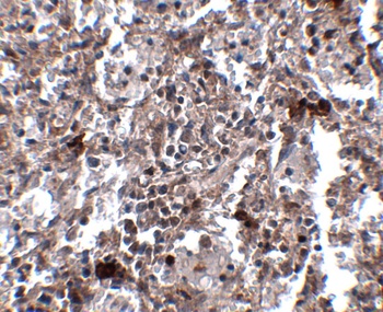 KCTD15 Antibody