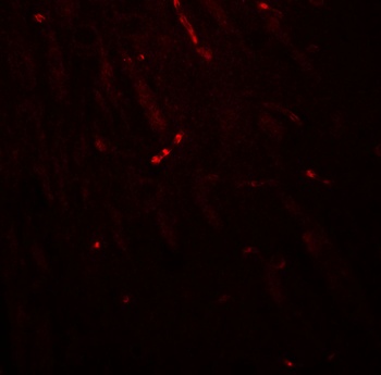 KCNK1 Antibody