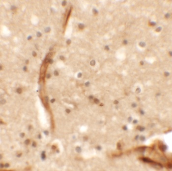 KCNK13 Antibody