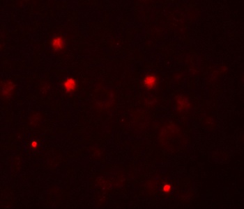 KCNK13 Antibody