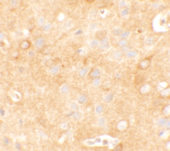 KCNK12 Antibody