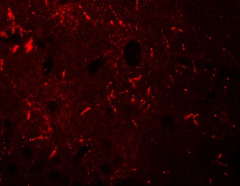 KCNK12 Antibody