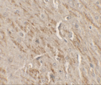 KAT5 Antibody