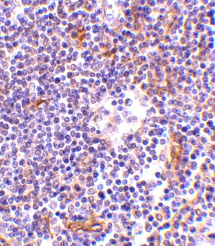 NKIRAS1 Antibody