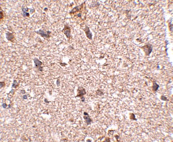 JPH3 Antibody