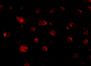 JPH3 Antibody