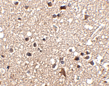 JPH3 Antibody