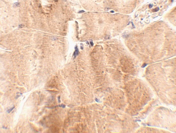 JPH4 Antibody