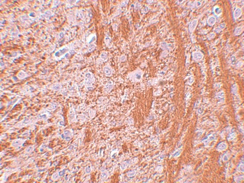 JMJD6 Antibody