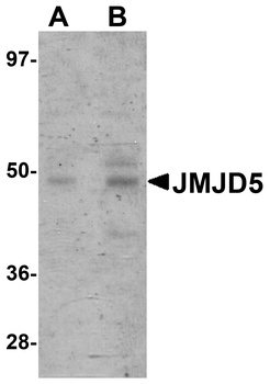 JMJD5 Antibody