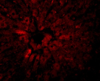 JMJD5 Antibody