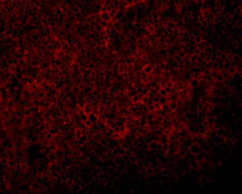 JMJD4 Antibody