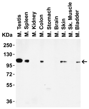 LSD1 Antibody