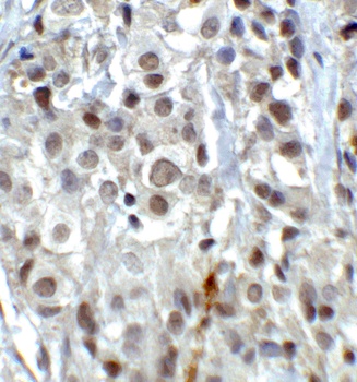 KDM1 Antibody