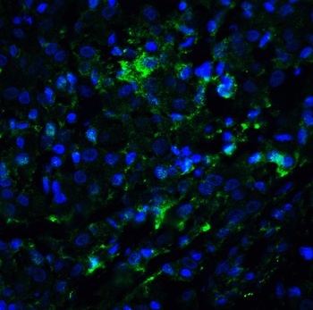 LSD1 Antibody