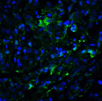 KDM1 Antibody