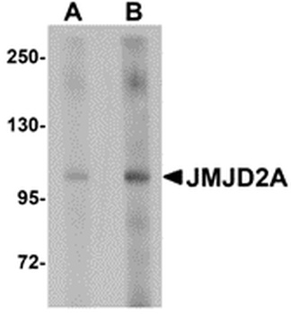 KDM4A Antibody
